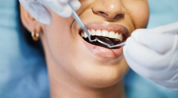 Best Emergency Dentist for Lost Fillings or Crowns in Sterling Ranch, CO
